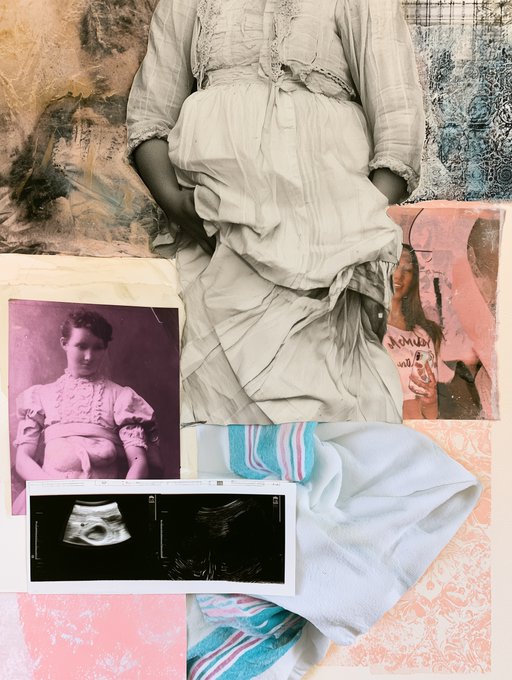 An artistic collage combining vintage sepia photographs of women in period dresses with medical ultrasound images and pink textured backgrounds.