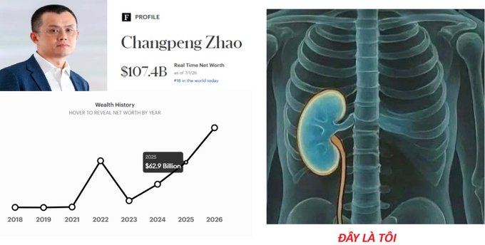 The image is a meme split into two halves: the left side shows a Forbes profile of Changpeng Zhao (CZ) displaying a net worth of $107.4B as of 7/1/26, #18 in the world, with a wealth history chart highlighting a jump from $62.9B to $107.4B between 2025 and 2026; the right side shows an anatomical illustration of a human kidney with the Vietnamese caption "ĐÂY LÀ TÔI" ("This is me"). The meme humorously contrasts CZ gaining $44.5B in six months while the poster jokingly claims to have "lost a kidney" in the same period, inviting others to share their own (lack of) accomplishments.