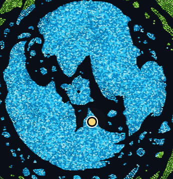 A blue-tinted, pixelated medical imaging scan of a knee joint with a white circular marker highlighting a specific area.