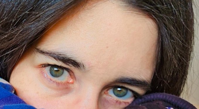 A close-up photo of a person's eyes and face, wearing a blue and purple patterned hood or garment, looking directly at the camera.