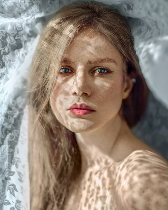 A portrait of a young woman with blonde hair and freckles lying down, with sunlight casting wavy shadows across her face and body.