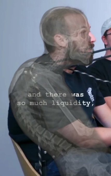 A man in a black shirt is overlaid with a semi-transparent X-ray view showing his skull and skeletal structure, with the caption "and there was so much liquidity," creating a visual metaphor for the post's reference to shareholder value being "drained."