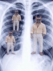 Three men wearing dog masks stand inside a chest X-ray, representing the rapid growth of "DAWG on BNB" trending #1 across social media. The surreal, larger-than-life imagery symbolizes the explosive hype and viral momentum of the project, with the figures dominating the lung cavity much like DAWG dominating the crypto charts.