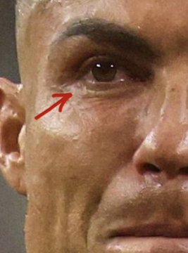 Close-up of a man's face with a red arrow pointing to the corner of his eye.
