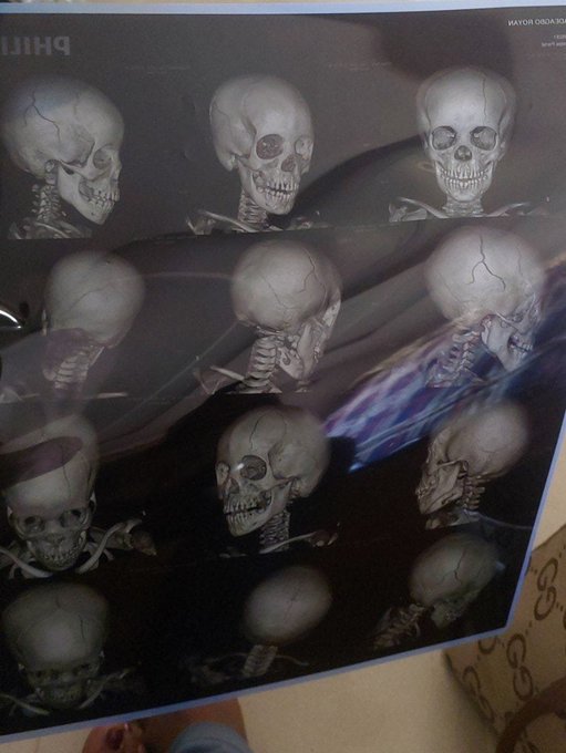 A close-up view shows a PHILIPS monitor displaying a repeating pattern of 3D-rendered human skulls in various angles against a dark background.