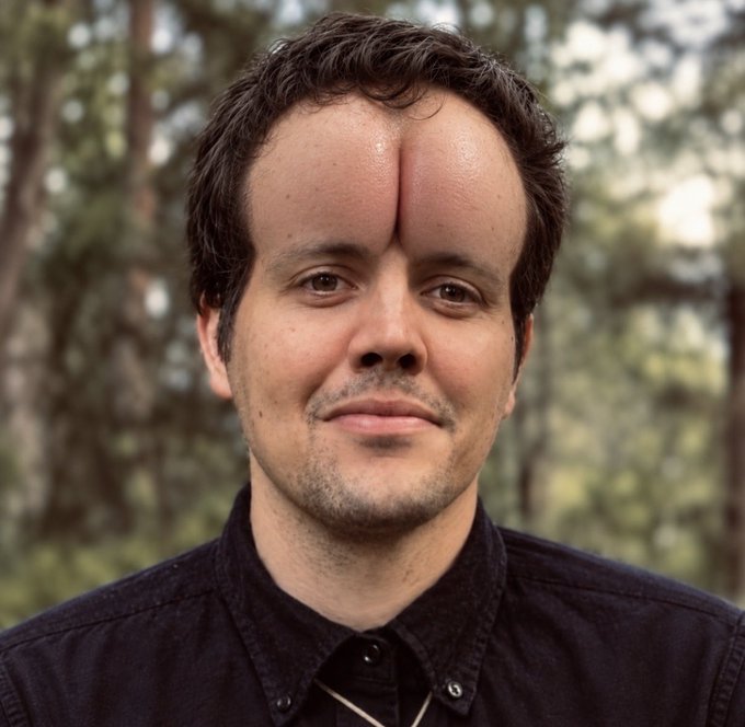 A portrait of a man with a digitally altered forehead featuring a large, prominent bump.