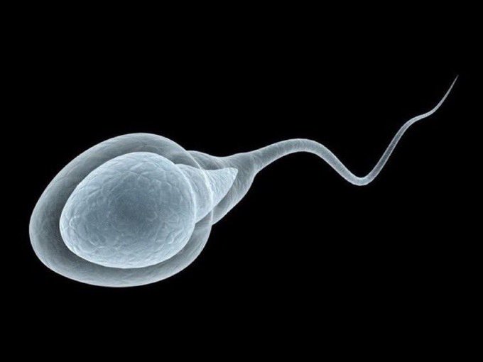 A scientific microscopic image showing a sperm cell with an enlarged, textured oval head and a long wavy tail against a black background.