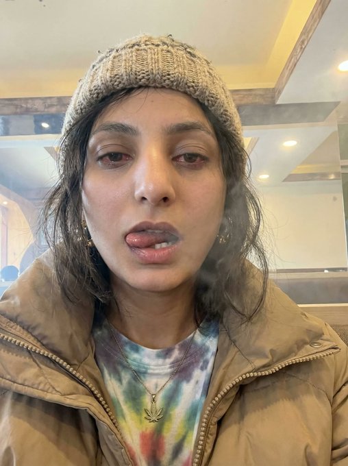 Selfie of a woman wearing a beige knit beanie, tie-dye shirt, and tan puffer jacket, with red eyes and a swollen lip.
