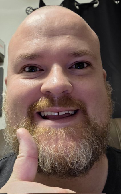 A close-up selfie of a smiling, bald man with a reddish-blonde beard giving a thumbs-up gesture.
