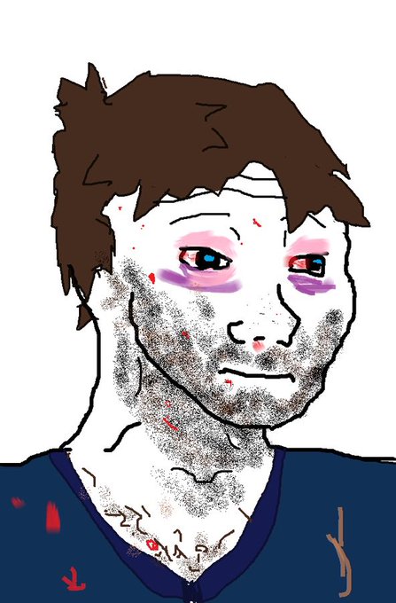 The image is a digital drawing/wojak-style portrait of a bruised and battered young man with brown hair, dark circles under his bloodshot eyes, stubble, and visible cuts and scratches on his face and neck. He wears a dark blue shirt with red bloodstains, visually reinforcing the post's "Last dip?" by depicting someone who has endured significant damage or hardship, suggesting resilience after a market downturn.