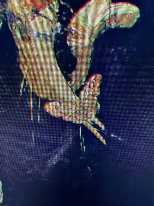 A distorted, glitchy image of a person in beige clothing and shoes against a dark background.