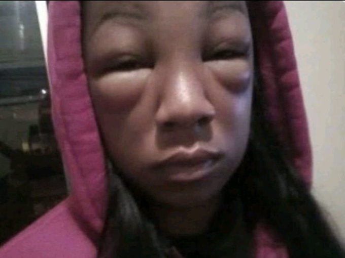 A close-up selfie of a person wearing a pink hoodie with the hood up, looking at the camera with a neutral expression.