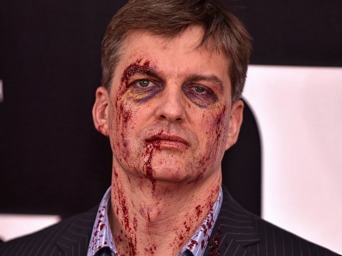 A man in a suit with battered and bloodied bruises around his eyes symbolizes the brutal losses faced by 115,154 crypto traders who were liquidated for $762.45 million while trying to short the market during a major pump. The image's battered face visually captures the steep cost paid by bearish traders caught on the wrong side of the rally.