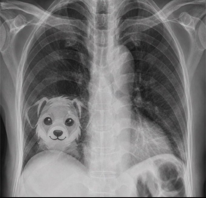 A black-and-white chest X-ray image with a cartoon bear face superimposed over the heart region on the left side of the chest.