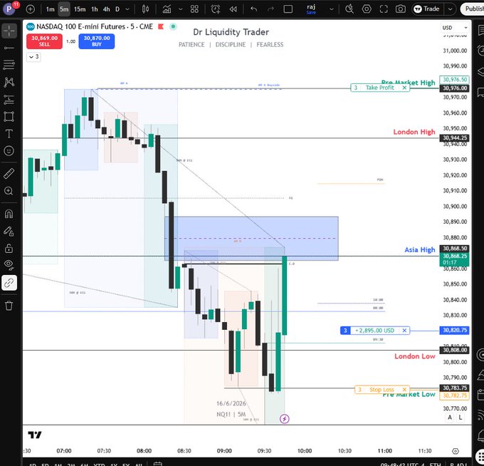 The image shows a trading dashboard from the NQ market maker, showing a chart of two technical indicators that are fluctuating between blue and green. The chart displays the SMA (Simple Moving Averages) for the two indicators with periods ranging from 1 to 5 days. This information can be used by traders to analyze trends in the stock markets and make trading decisions based on historical price data. The image also contains a caption stating "Focus on what is in the image".