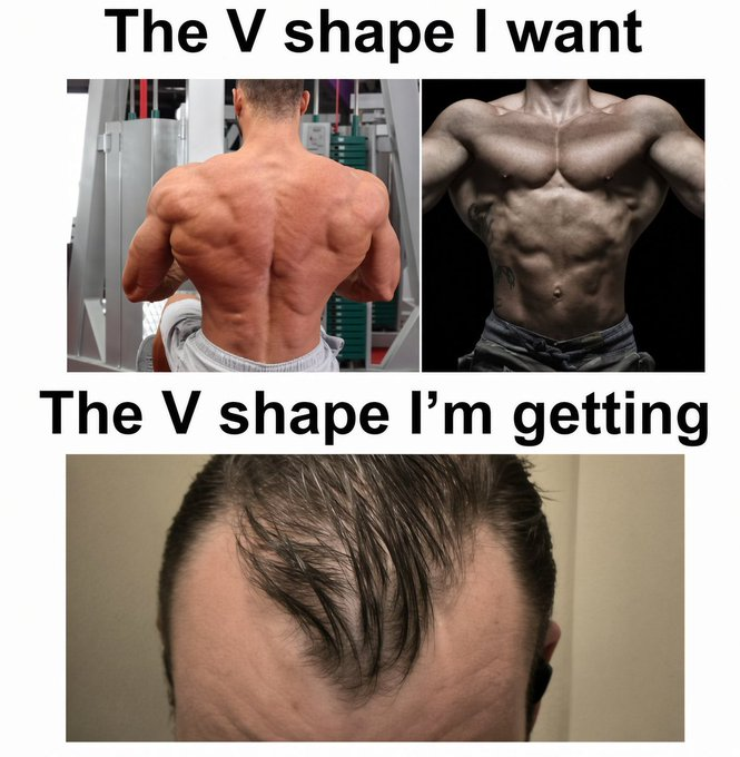 A humorous meme showing two muscular physiques labeled "The V shape I want" contrasted with a receding hairline labeled "The V shape I'm getting," joking that the "crypto bro" lifestyle is delivering hair loss instead of a chiseled back.