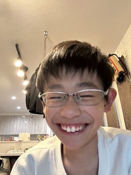 A smiling 13-year-old boy with glasses and braces beams at the camera in a kitchen setting, embodying the youthful success story of a teen who turned summer boredom into $20,000 by learning Python and building an automated trading script for Polymarket prediction markets.