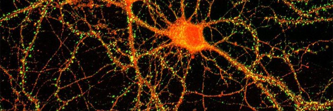 A fluorescent microscopy image showing a neuron with its soma and branching dendrites, stained in orange and green against a black background—likely used to illustrate the fruit-fly neural circuit ($FlyFUND) referenced in the post.