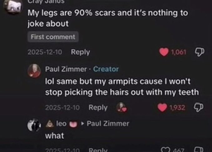 A screenshot of social media comments where user Craig Janos states 'My legs are 90% scars and it's nothing to joke about', followed by creator Paul Zimmer replying with a joke about his armpits.
