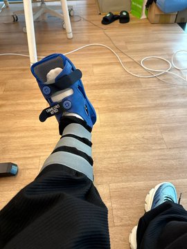 A person's foot wearing a blue medical walking boot and striped socks rests on a wooden floor, with cables and household items visible in the background.