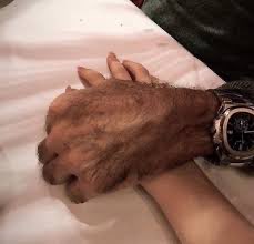 Two weathered, elderly hands gently clasped together, one wearing a silver wristwatch, resting on a soft white surface.