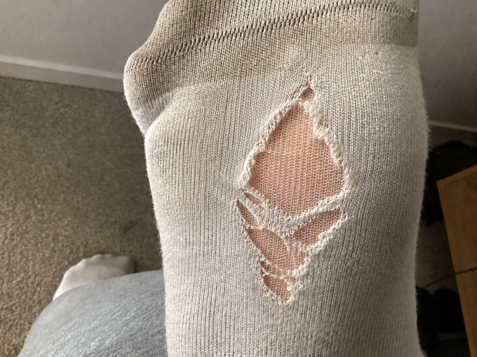 A close-up of a white knit sock with a large tear/hole in it, showing skin through the damaged fabric, taken indoors on what appears to be carpeted flooring.