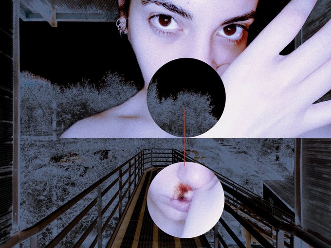 A close-up of a woman's face is layered above an industrial staircase scene, with a magnifying glass effect revealing the chapped lips and a nosebleed that the caption describes as hidden behind her "pretty face." The circular insets emphasize the intimate, unseen details of vulnerability—emphasizing the message "i'll never let you SEE"—while the "last 3 editions left, 5 tezos" text points to this being a digital art piece listed for sale.