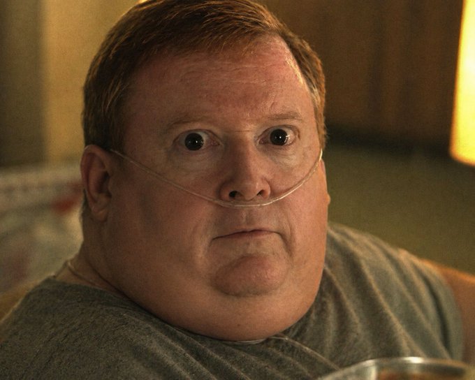 A close-up photo of a man with short brown hair wearing a nasal oxygen cannula, looking off-camera with wide eyes, dressed in a gray shirt in a warmly lit indoor setting.