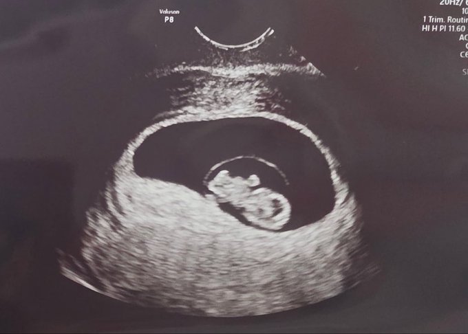 An early first-trimester ultrasound (labeled "Voluson P8," "1 Trim. Routin," and "HI H PI 11.60") shows a tiny gestational sac with a developing embryo, illustrating the post's playful announcement of "i looked at my girl and said 'let's build'"—capturing the moment they decided to start their family.