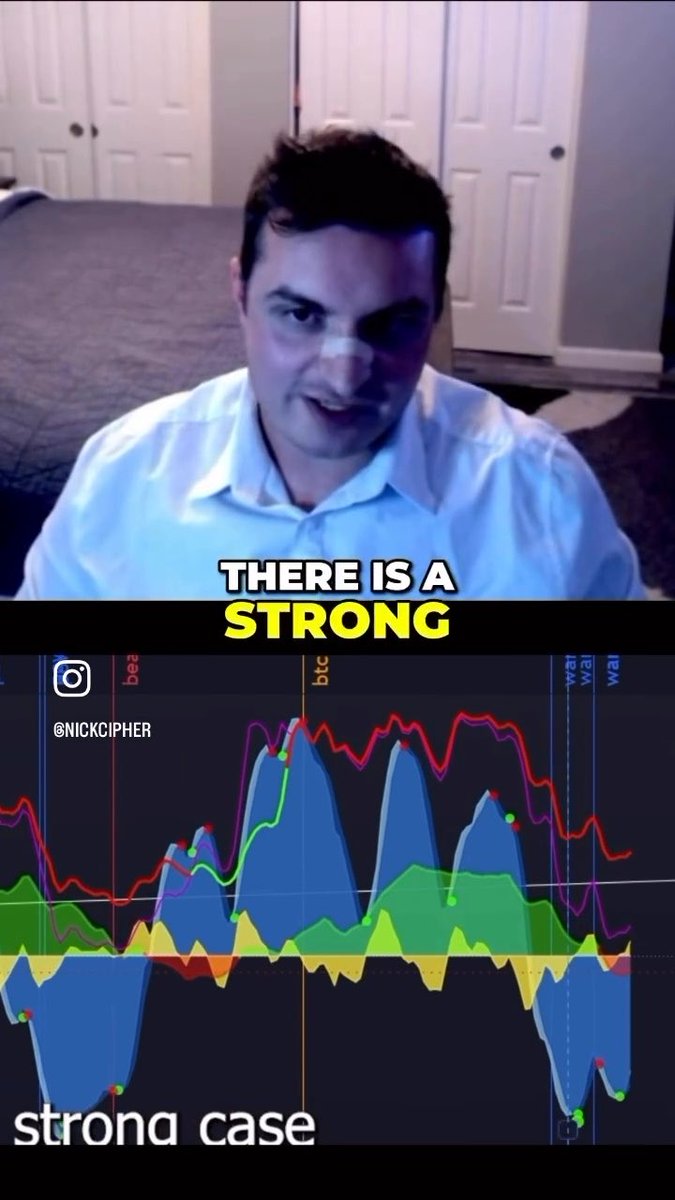 A split image showing a man in a white shirt with a nose bandage in the top half captioned 'THERE IS A STRONG', and a colorful multi-indicator crypto chart in the bottom half captioned 'strong case' by @NICKCIPHER.