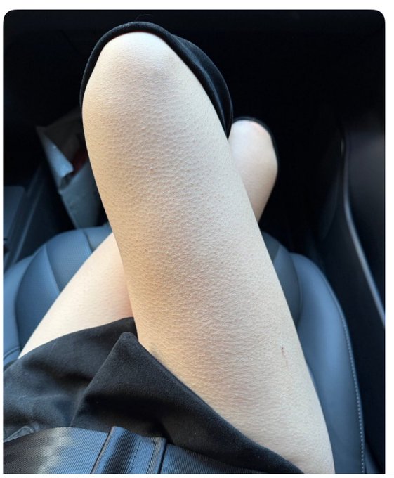 A person's legs are crossed in a car, showcasing a close-up of their knee and thigh in black shorts, seemingly in a relaxed pose during a drive.

The image of the person casually resting their legs in the car complements the post's tone of personal reflection and satisfaction, as the user reflects on past generosity being rewarded and hopes for similar good fortune for kind-hearted strangers in the crypto community.