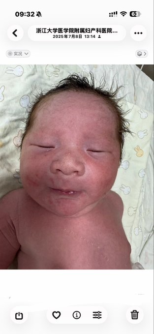 A screenshot of a phone screen displaying a close-up photo of a sleeping newborn baby from 浙江大学医学院附属妇产科医院 (Zhejiang University Medical College Affiliated Obstetrics and Gynecology Hospital) dated 2025年7月8日 13:14.