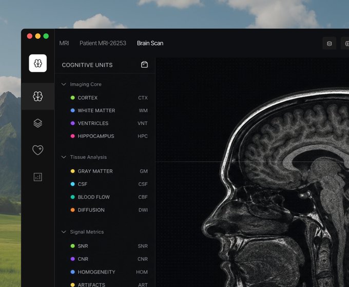 A macOS application interface showing an MRI brain scan analysis tool, with a sidebar listing cognitive units like CORTEX, WHITE MATTER, and VENTRICLES.