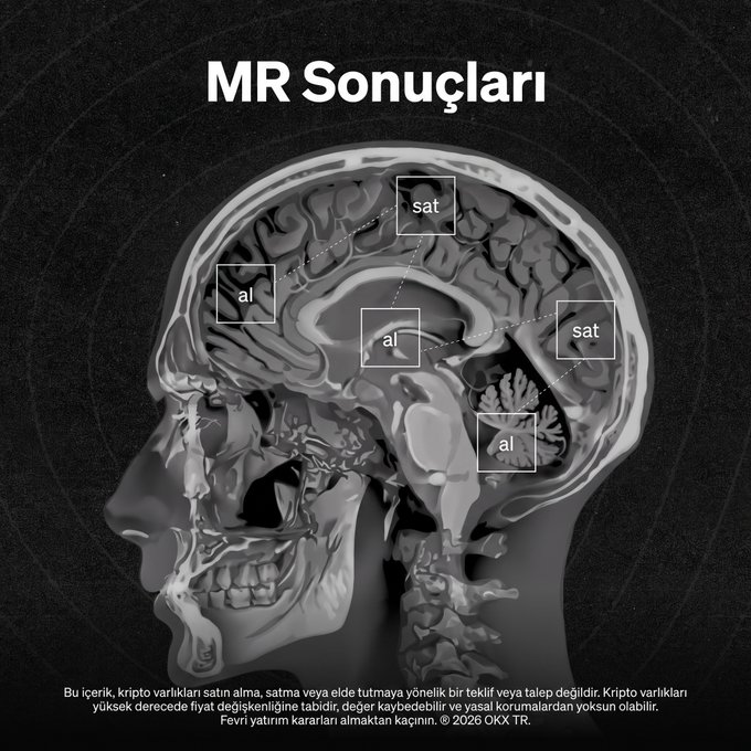 A sagittal MRI brain scan titled "MR Sonuçları" (MRI Results) is shown against a black background, with five boxes highlighting regions labeled "al" (buy) and "sat" (sell) pointing to different parts of the brain. A disclaimer at the bottom warns that crypto assets carry risk and are not legally protected or guaranteed, credited to OKX TR.