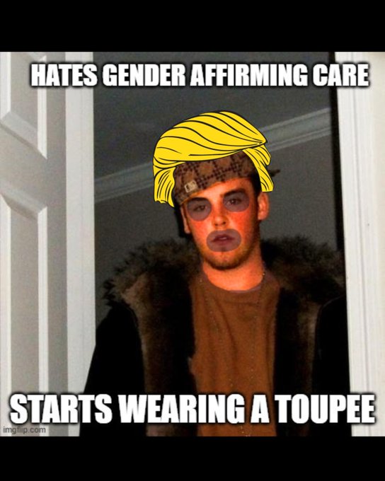 A meme featuring a person with cartoonish yellow hair and orange skin editing with the top text 'HATES GENDER AFFIRMING CARE' and bottom text 'STARTS WEARING A TOUPEE.'