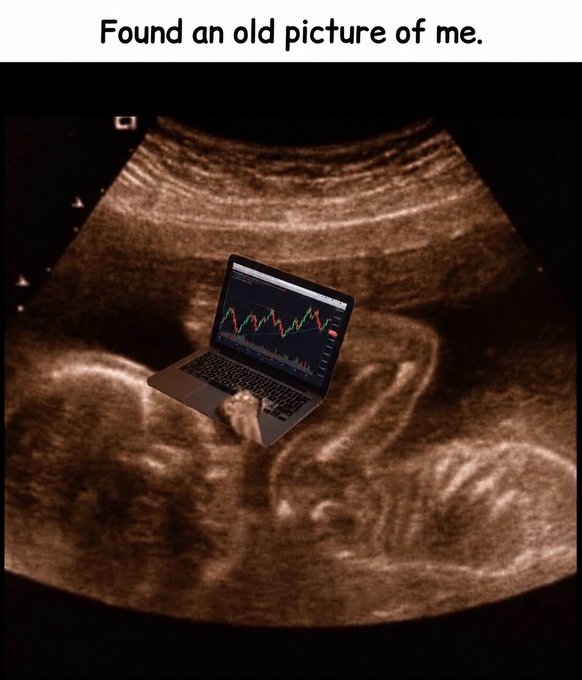 A humorous ultrasound image with a laptop displaying a stock market candlestick chart digitally superimposed over the fetus, with the caption 'Found an old picture of me.' at the top.