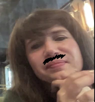 A close-up of a young woman with brown hair rests her chin on her hand in a dimly lit setting, with a black censor mark edited over her nose area.