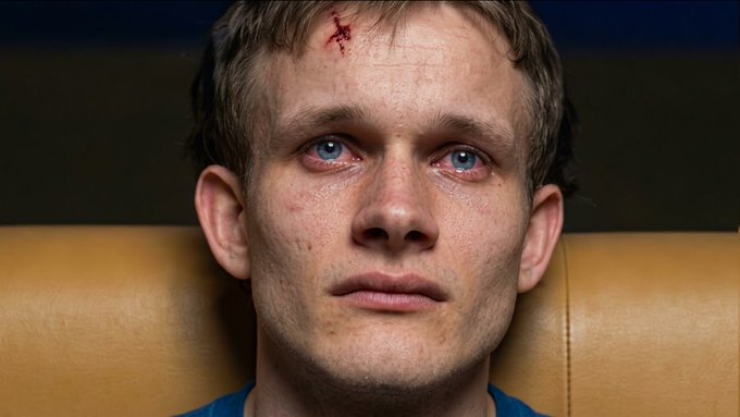 A close-up shows a man with bloodshot, teary eyes and a small bleeding cut on his forehead, staring forward in pain and defeat. The image visually captures the anguish of Ethereum supporters helplessly watching rival blockchains outperform theirs.