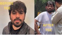 A before-and-after comparison photo showing a bearded man, labeled 'BEFORE TGE' and 'AFTER TGE', apparently depicting a transformation.