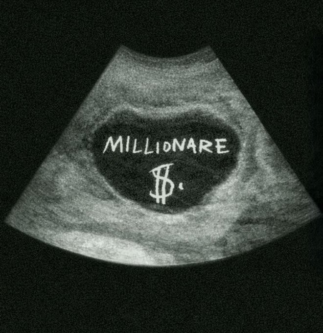 A grainy black-and-white ultrasound image displays a dark oval shape with handwritten white text reading "MILLIONARE" above a stylized dollar sign, cleverly playing on the post's theme of "birthing millions in crypto" by depicting wealth as something being delivered like a baby.