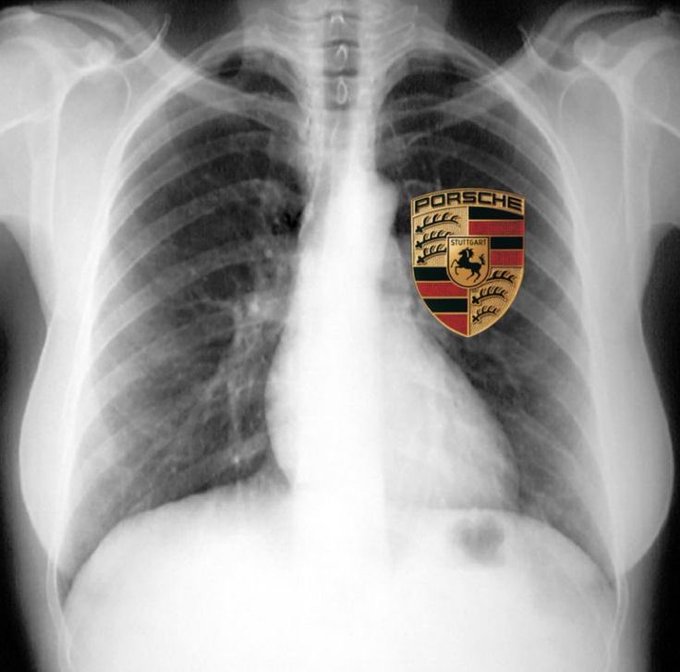 A chest X-ray with the Porsche Stuttgart emblem digitally placed over the left lung area, humorously pairing the brand's iconic shield—reading "PORSCHE STUTTGART" with its rearing horse and antler crests—with the phrase "that's what you should really know about me," implying the person identifies with or is passionate about Porsche as a core part of their identity.