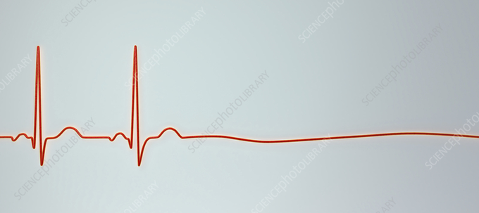 An ECG/EKG tracing on a light blue background showing two prominent cardiac spikes before flattening into a nearly flat line, visually mimicking the dramatic drop and stagnation often seen in NFT market charts. The image is watermarked with "SCIENCEPHOTOLIBRARY" across it.