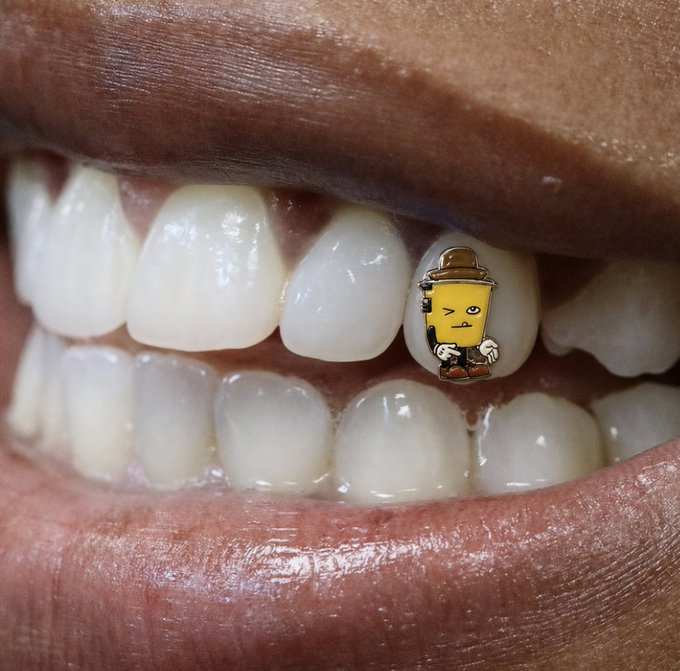 Close-up of a person's smile showing white teeth, with a decorative gold and yellow tooth cap (grillz) featuring a cartoon character design on one of the upper teeth.