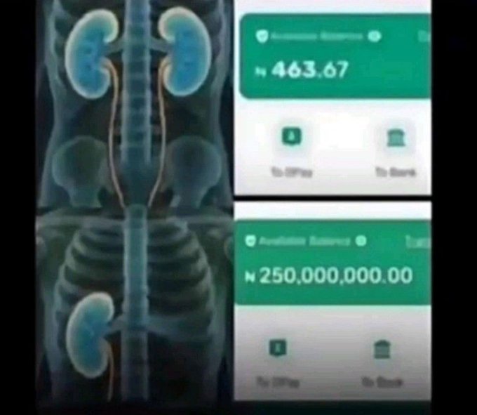 The image shows an X-ray or anatomical illustration of a human torso displaying three kidneys (two upper, one lower) paired with two digital banking/transfer screens showing ₦463.67 and ₦250,000,000.00 in Nigerian Naira. The "extra kidney" paired with a massive 250 million Naira transfer humorously visualizes the "Plan B after crypto" caption, suggesting that having an extra kidney to sell could be a backup financial strategy if cryptocurrency investments fail.