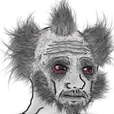 This image depicts a stressed, disheveled Wojak character, perfectly embodying the "rekted" sentiment of those who lost money in Robinhood Chain after the World Cup, as described in the accompanying post. The text in the post contrasts this image with those who "printed solid figures," highlighting the extreme outcomes from trading on the chain.