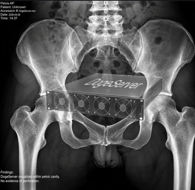 A stylized X-ray of a pelvis showing a server rack labeled 'DogeServer' positioned within the pelvic cavity, with findings text reading 'DogeServer visualized within pelvic cavity. No evidence of perforation.'