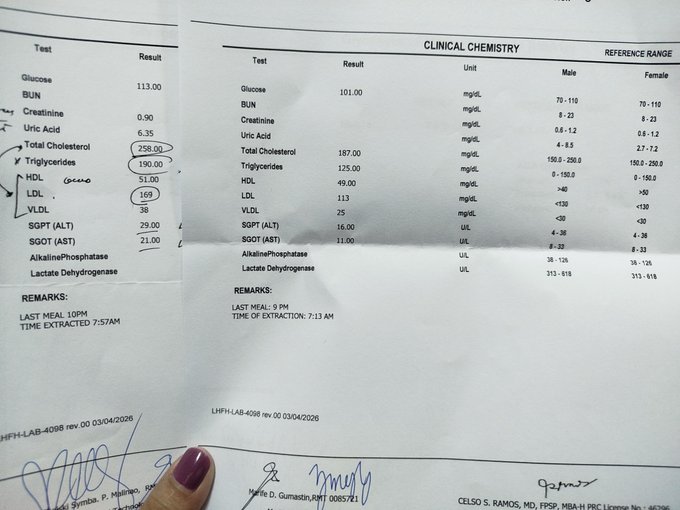 Two clinical chemistry lab result documents side by side, showing blood test values for glucose, BUN, creatinine, uric acid, cholesterol, triglycerides, HDL, LDL, VLDL, SGPT, SGOT, and alkaline phosphatase, with several results highlighted in circles (258.00, 190.00, 51.00, 169) and doctor signatures at the bottom.