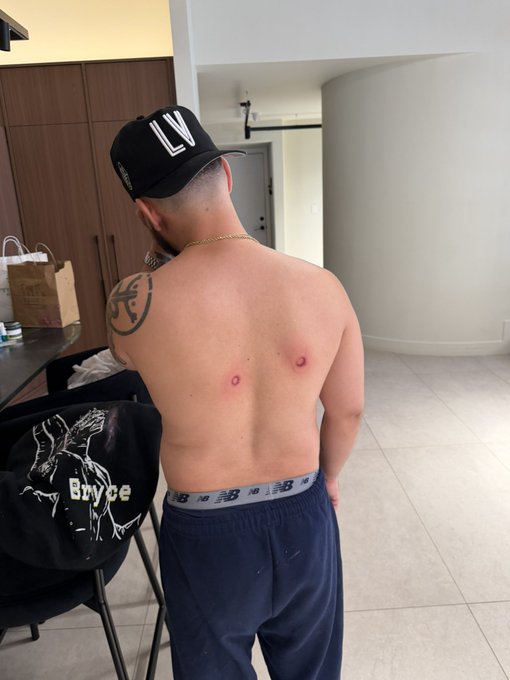 A shirtless man in an “LV” cap and navy pants stands with his back to the camera, showing two red marks on his upper back; a nearby black hoodie reads “Bryce.” The image illustrates the accompanying Roobet promotion offering a $500 discount with code “bryce,” jokingly contrasting the offer with being shot by a paintball gun.