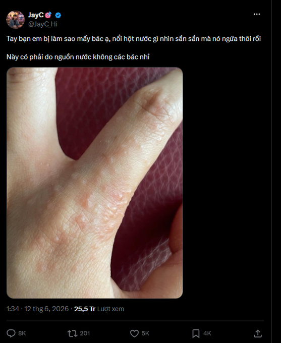 The main focus of this image is a picture of someone's hand that has bumps or spots on it. This image is part of a larger Twitter account where people share various posts, including photos of themselves or objects they find interesting. In the context of this post, the person with the bumpy skin might have posted about personal experiences or observations related to skin issues or other skin conditions. The number of likes and shares on this particular post can indicate that it has gained a considerable amount of attention from users, possibly sparking conversations or discussions around the shared content.