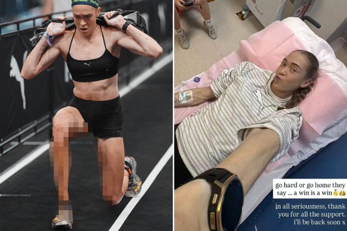 A side-by-side comparison showing an athletic woman performing a weighted exercise on the left, and the same woman lying in a hospital bed on the right with text reading 'go hard or go home they say .. a win is a win' and 'in all seriousness, thank you for all the support. i'll be back soon x'.